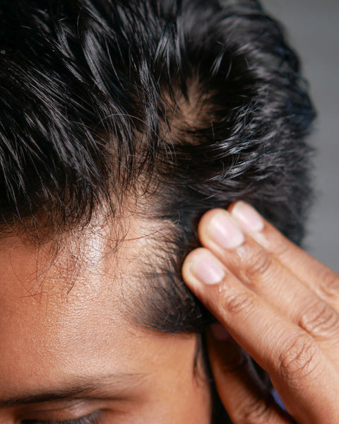 man with thinning hair touching scalp